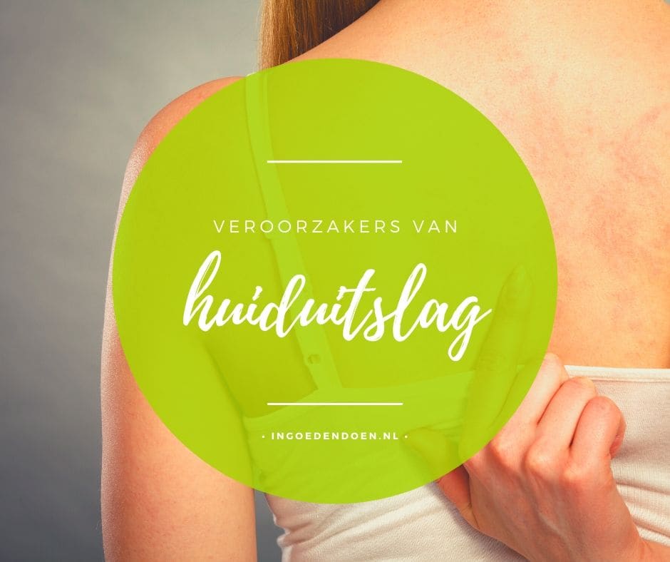 huiduitslag - welke oorzaken zijn er?
